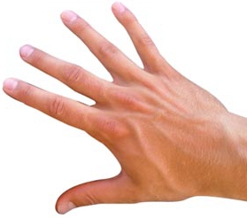 Німіє палець правої або лівої руки: причини