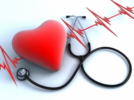 Інфаркт міокарда: симптоми та причини