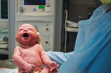 Синдром заходящего солнца у новорожденных может быть признаком тяжелой болезни - fitdiets.ru