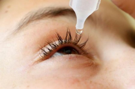 Краплі для очей від алергії: відгуки. Які краплі для очей від алергії краще?