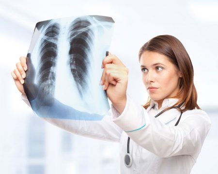 Що таке кальцинати в легенях?