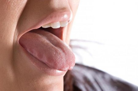 Що робити, якщо обпекла язик: лікування, народні рецепти