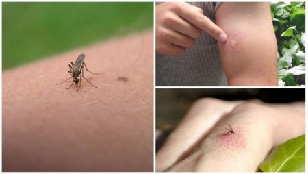 Як лікувати укуси комарів: 2 популярних способи
